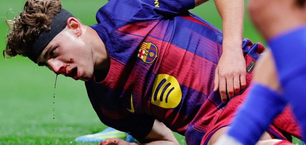 فيرمين يخضع لعلاج مكثف بعد إصابة قوية في مواجهة أتلتيكو مدريد – يلا لايف
